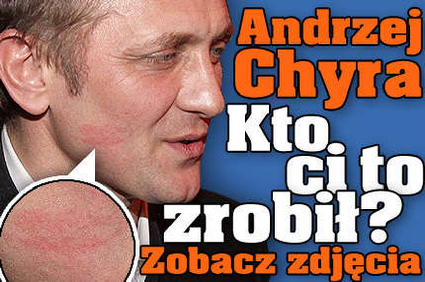 Andrzej Chyra. Kto ci to zrobił?