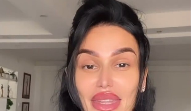 Indi Aradinović korigovala usne i obrve