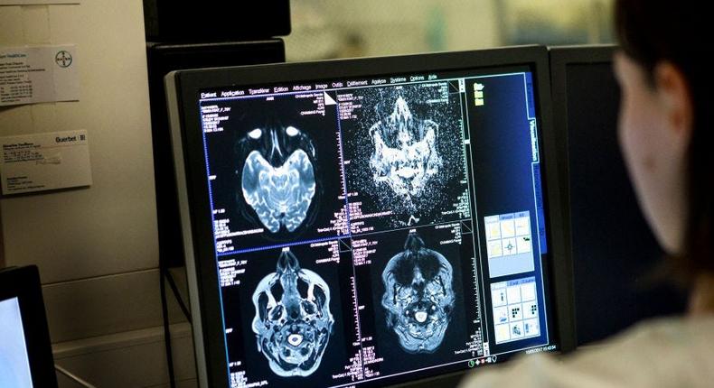 Medical imaging service in a hospital in Savoie, France. A technician monitors a brain MRI scan session.
