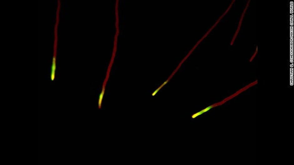 Kristijan Šekjuber - Podospora anserina (gljivice), vlaknaste endotelske ćelije