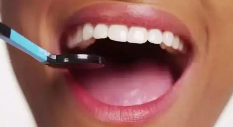 5 ways to naturally whiten your teeth at home. [eve9world]