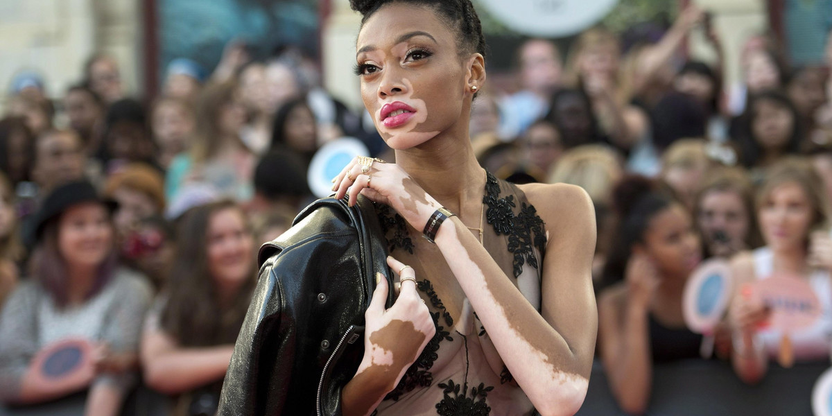 Winnie Harlow 