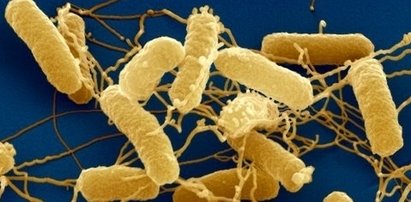 Salmonella w mięsie znanego producenta?