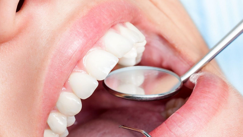 Nieleczone zęby źródłem poważnych problemów zdrowotnych