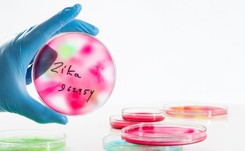 Wirus Zika może wywołać nową pandemię. Wystarczy niewielka mutacja