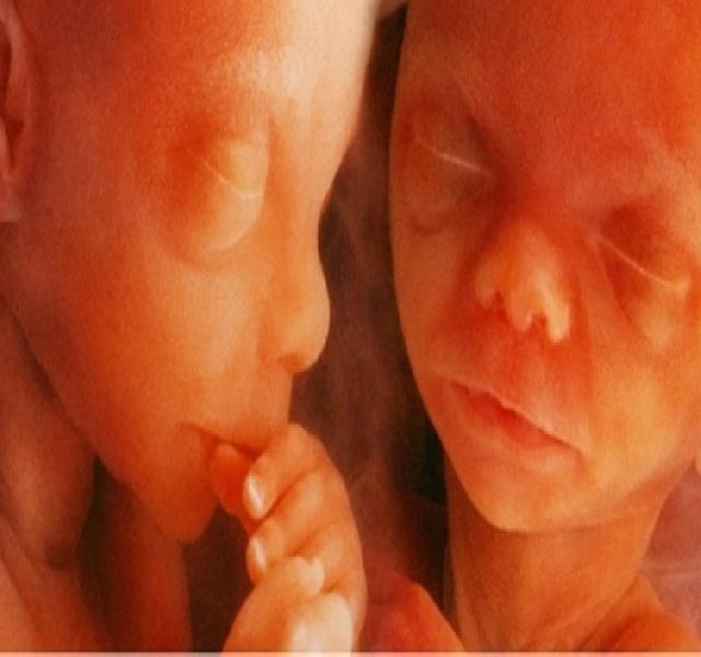 Ikrek fogyása terhes, Hogyan lehet terhes az ikrek - Tesztek