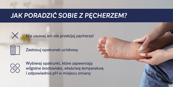 Jak poradzić sobie z pęcherzem? - infografika