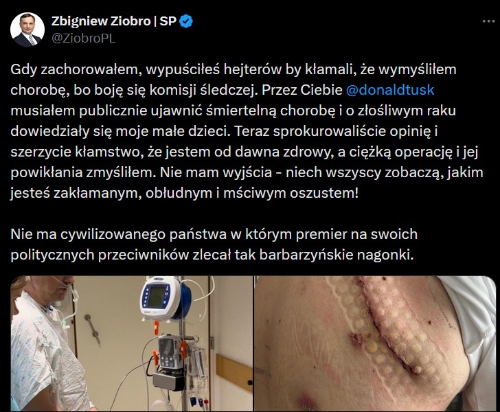 Wpis Zbigniewa Ziobry na portalu X