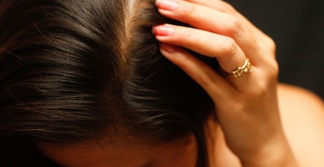 670px-choose-the-right-hair-loss-option-step-3