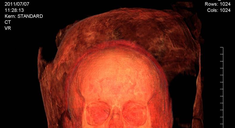 CT scanning and subsequent 3D imaging of a wooden coffin poignantly revealed an ancient Egyptian teenage boy who was mummified and placed into a coffin that was too large for him.