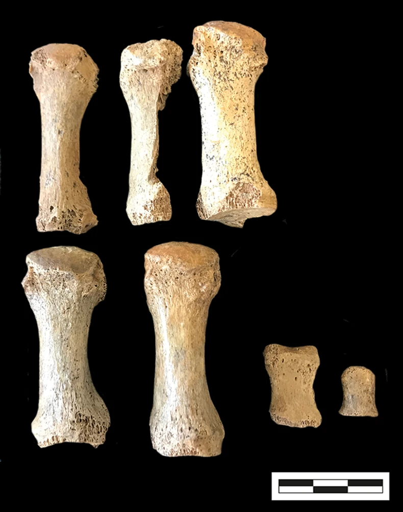 Nožni prsti 5 različitih osoba