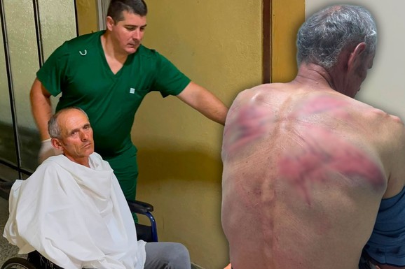 (FOTO, VIDEO) "STAVILI SU MI LISICE, KRPU NA USTA, VEZALI ME ZA BUKVU I TUKLI" Oglasio se Nenad kog je tzv. kosovska policija brutalno pretukla: "Upala su trojica u moju kuću..."