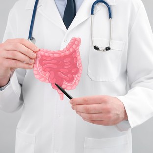 Így jelzi előre bélflóránk a Crohn-betegség kiújulását