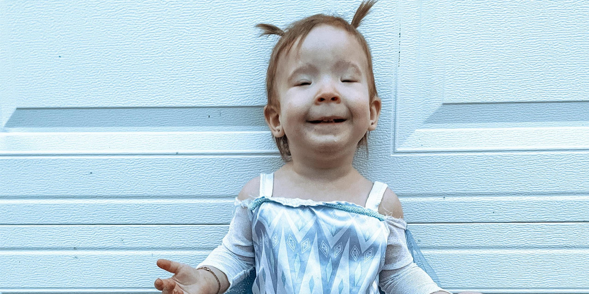Dwuletnia Lily przeszła operację, dzięki której w końcu widzi,