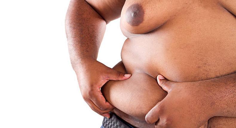 Obesity can lead to serious health problems if not addressed [iStock]