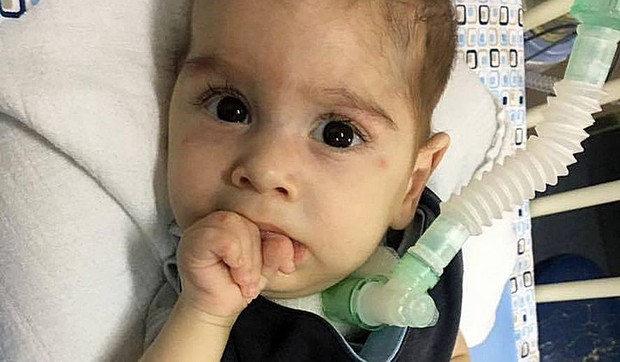 Oliver Pal Gajodi se bori sa SMA 1