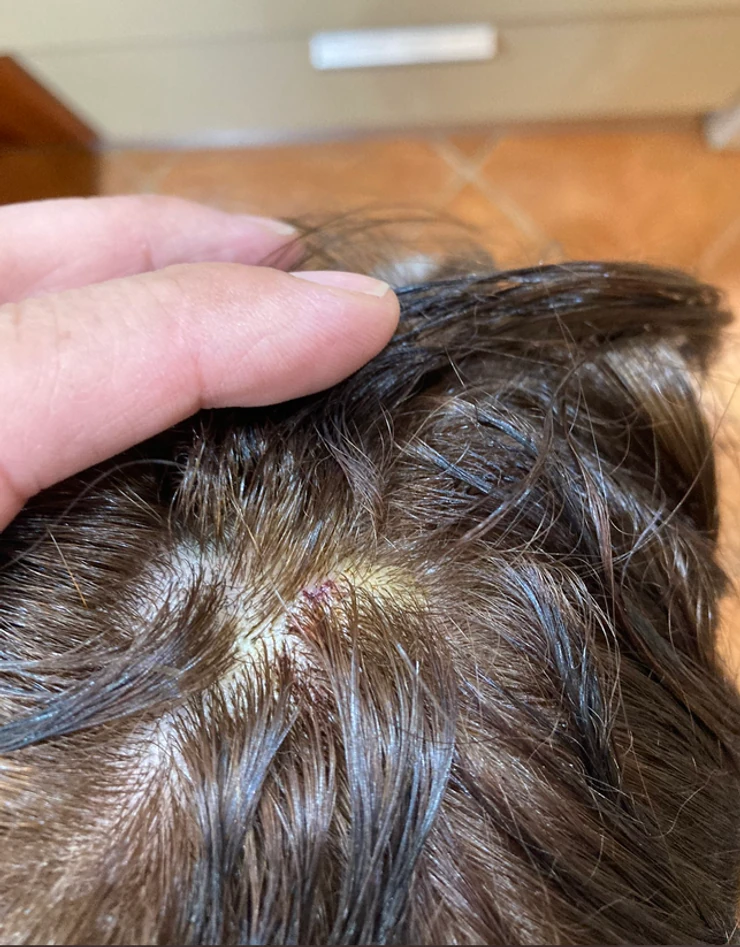 Dete koje je udarila vrana