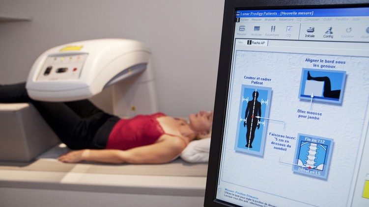 csontsűrűség mérés fenzitometria, DEXA vizsgálat leírás