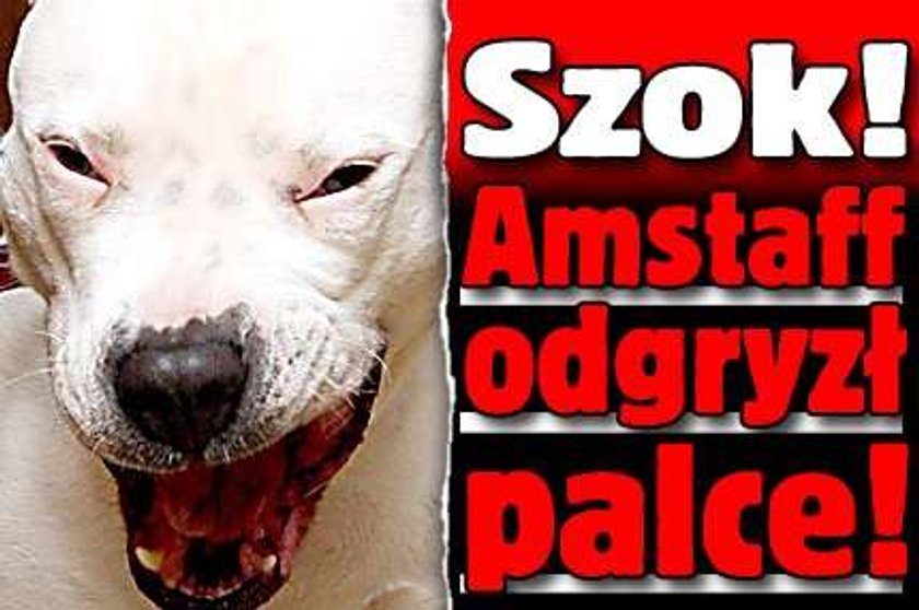 Szok! Amstaff odgryzł palce!