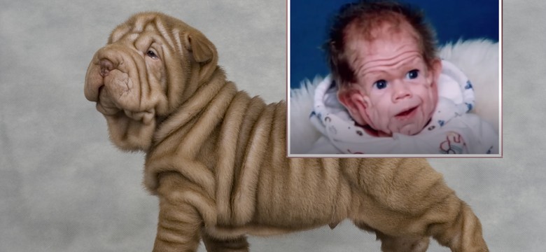 Gdy się urodził, miał skórę jak shar pei. Jak wygląda po 30 latach?