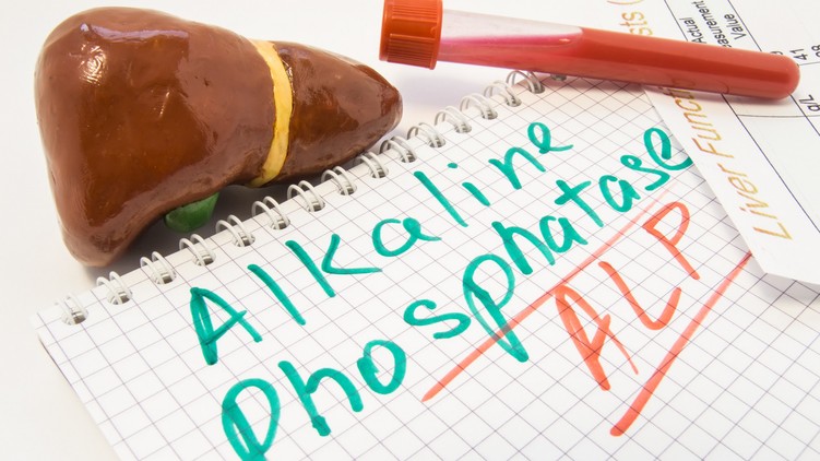 mit jelent ALP érték laborlelet