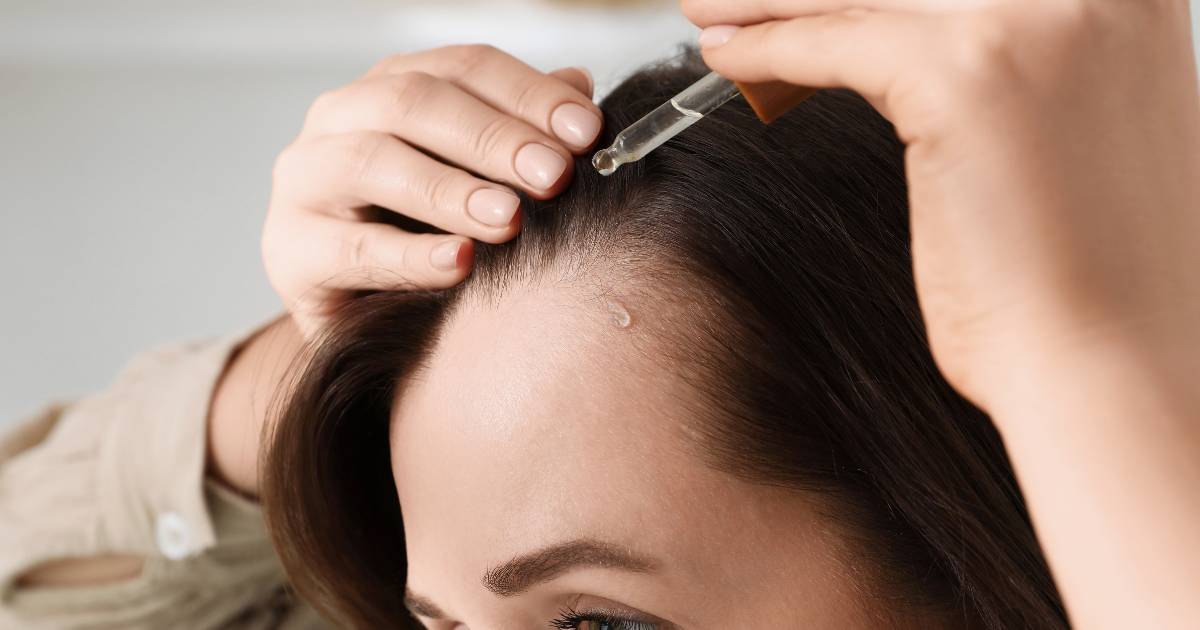 Remedium na łysienie! Ta wcierka do włosów działa cuda na zakola - daje wysyp baby hair