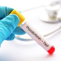 Mit jelent a prokalcitonin (PCT) érték a laborleleten?