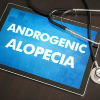 Kopaszodás, androgén alopécia oka, tünetei és kezelése