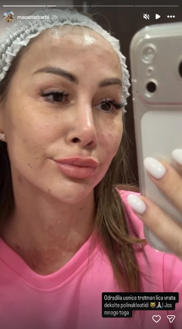 ŠTA JOJ SE DESILO SA VRATOM?! Starleta se snimala posle tretmana, svima se zgrčio stomak
