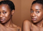 Pimple-free skin for under ₦6,000? Kiss pimples goodbye with these 5 products