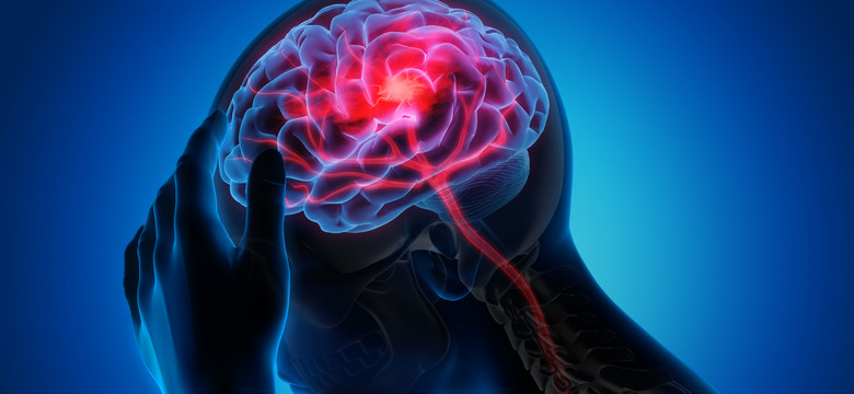 Według lekarzy COVID-19 może powodować udary mózgu wśród młodych osób