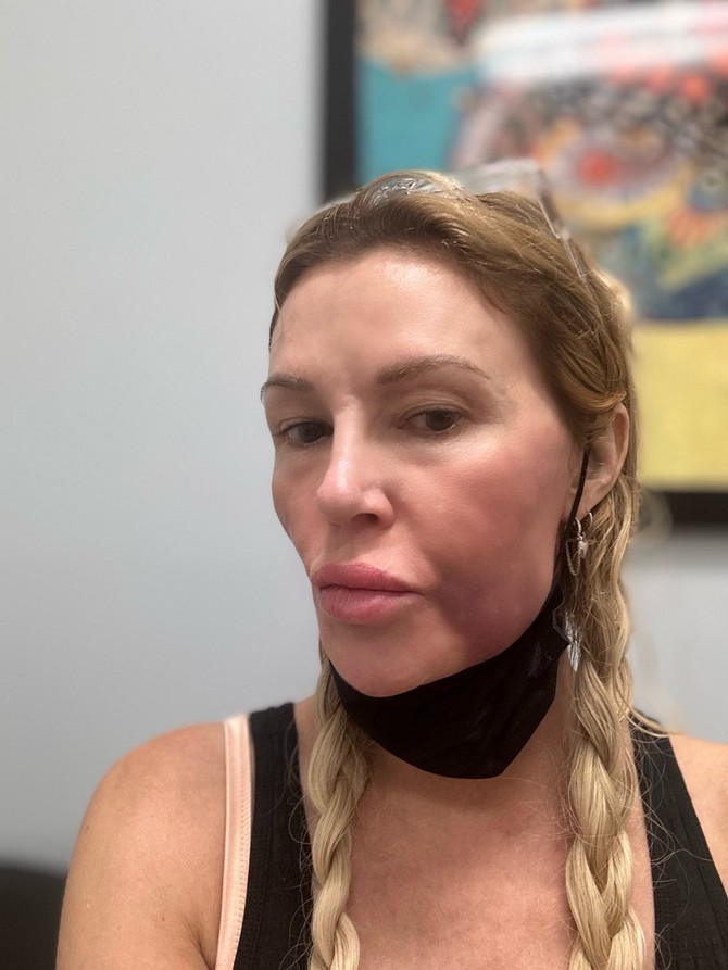 Brandi Glanvil