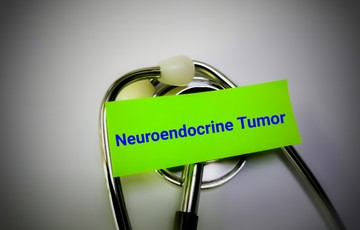Neuroendokrin daganatok