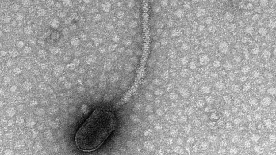 Na zdjęciu bakteriofag delta, po raz pierwszy zidentyfikowany w nowym badaniu opublikowanym w „Frontiers in Microbiology”, mający miejsca wiązania CtrA, fot. Tagide deCarvalho/UMBC