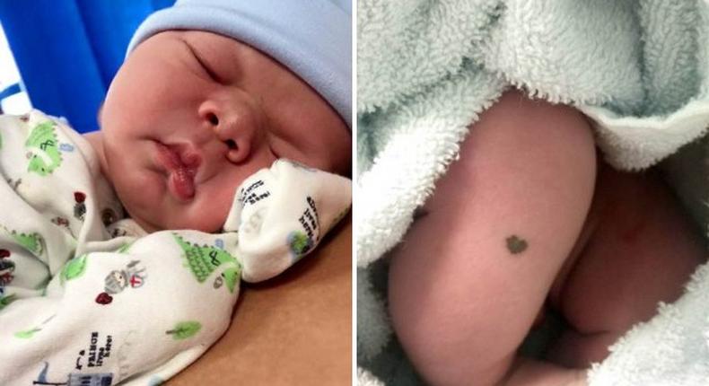 Meet Baby born with adorable heart-shaped smiley on his leg