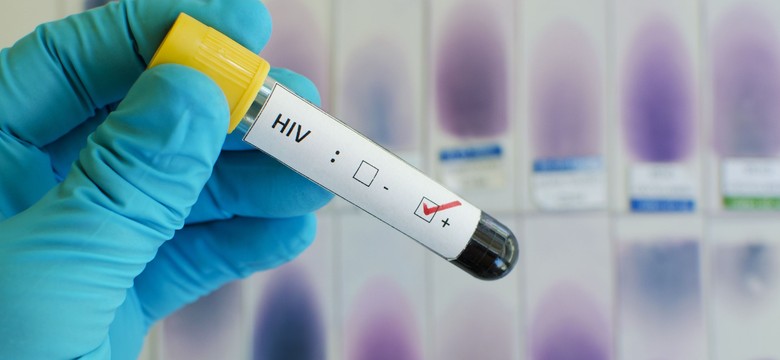 Trzeci przypadek wyleczenia z zakażenia HIV. Dzięki przeszczepowi krwi pępowinowej