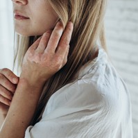 Ekcéma vagy pikkelysömör? Így különböztethető meg tünetek alapján a kettő