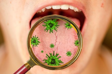 A szájzug-gyulladásáltalában legyengült immunrendszerű, vitaminhiányban szenvedőknél, kialakulásának a kockázatát növeli a szájpenész.