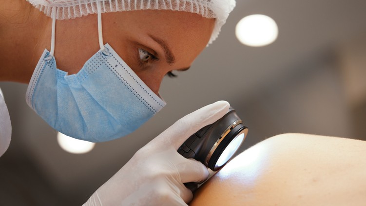 bőrrák, bőrdaganat, melanoma, fényvédelem