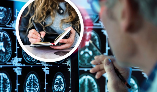 Neuredan rukopis može da ukazuje na tumor mozga