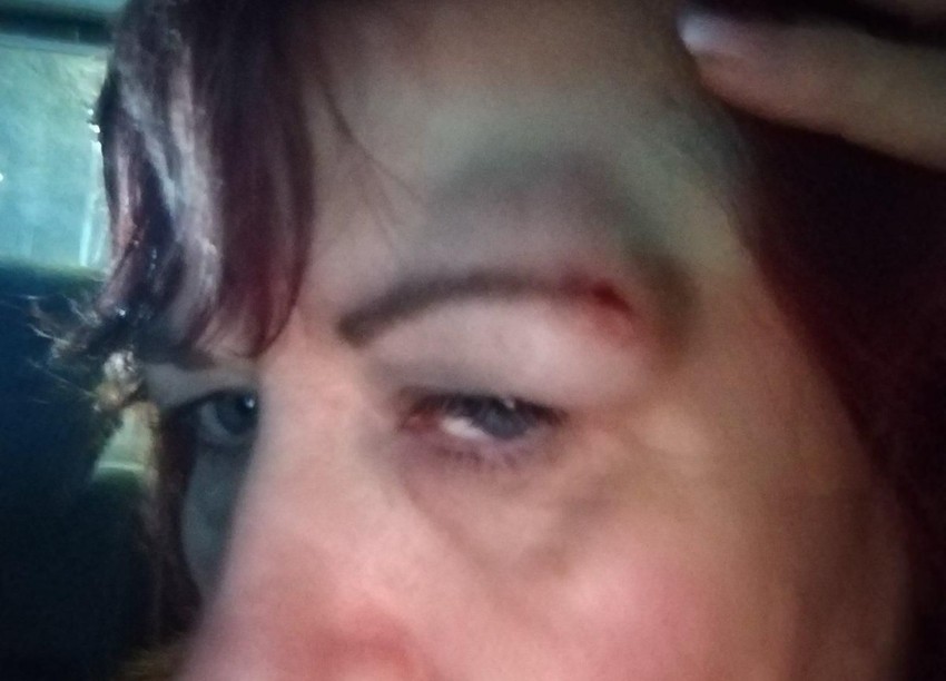 Napadnuta Danijela Krstić