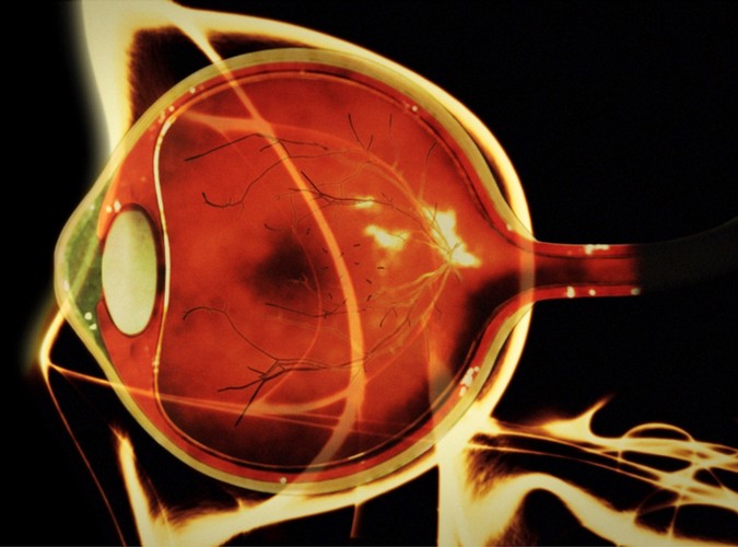 Toxoplasma gondii - ten pierwotniak wywołuje niezwykle groźną dla kobiet w ciąży toksoplazmozę. Powoduje ona uszkodzenia płodu. Nosicielem pasożytów są najczęściej koty i gryzonie, ale zarazić może również zakażone surowe mięso