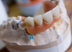 Czym się różni proteza elastyczna od zwykłej? Dentystka tłumaczy