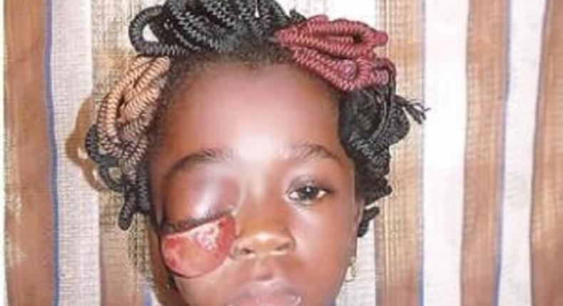 This little Kehinde Oke needs the assistance of Nigerians.