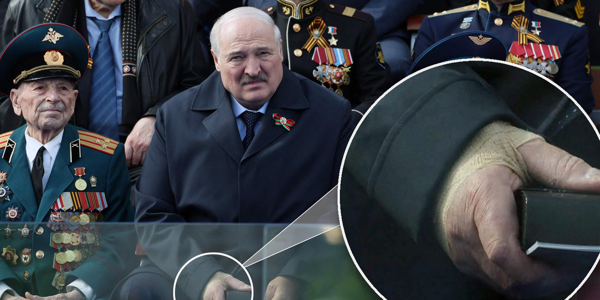 Łukaszenka miał w Moskwie opatrunek na dłoni.