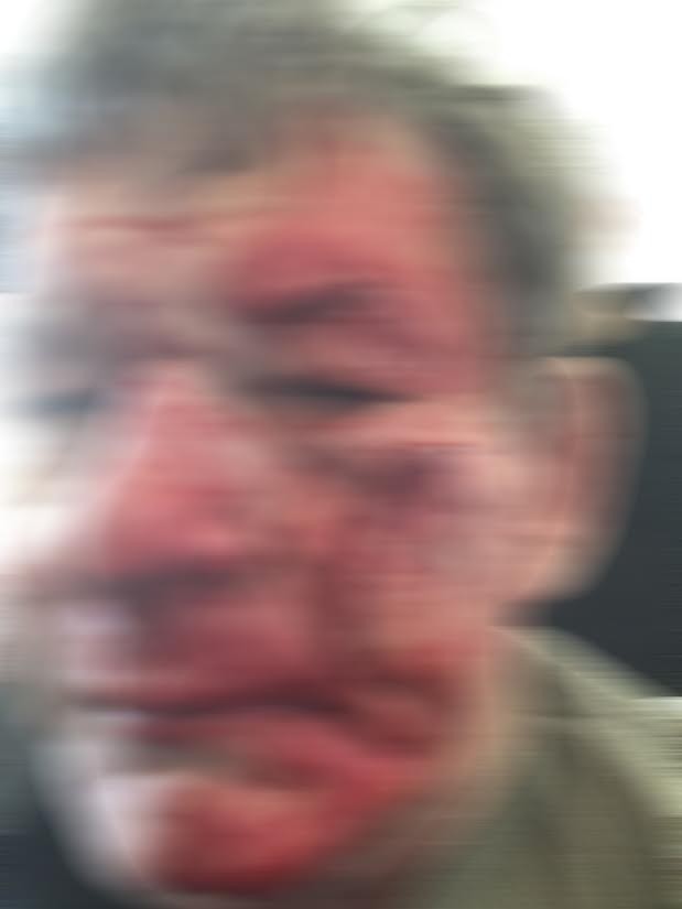 Francis fought with his dentist until fainting