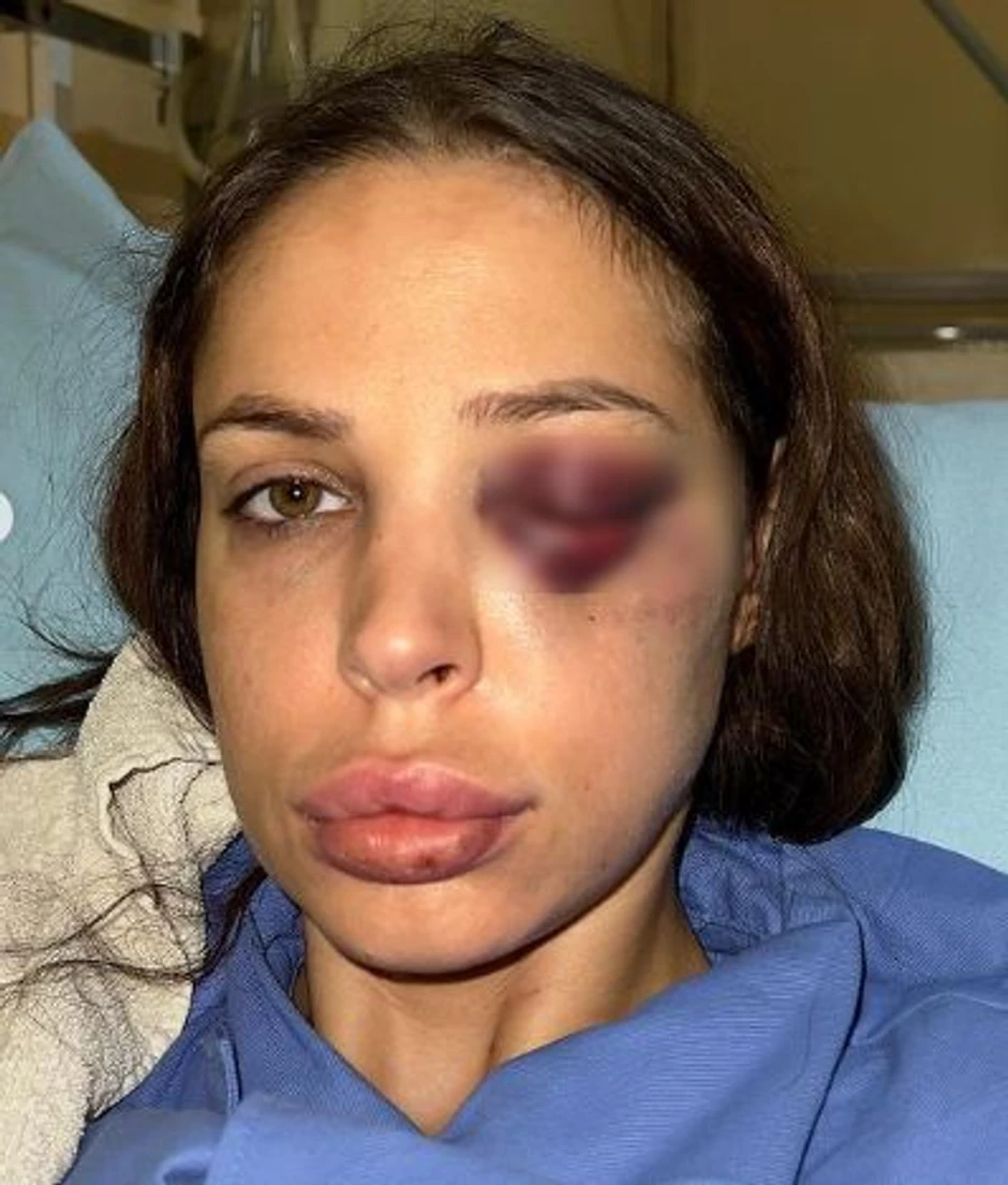 Pretučena Nataša Šavija