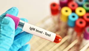 IgM antitela