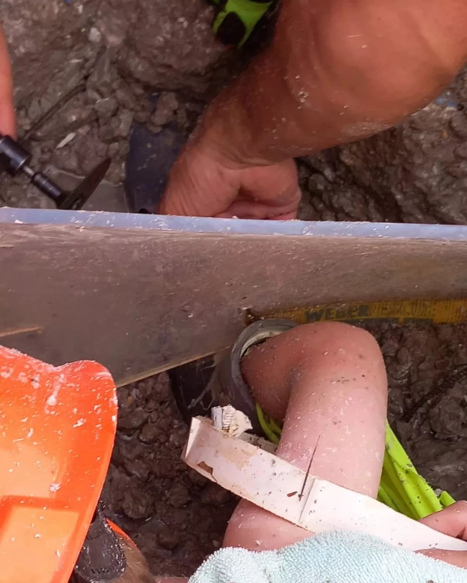 Dečak zarobljen do lakta