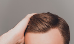 Jak zatrzymać proces utraty włosów?  Najczęstsze przyczyny łysienia